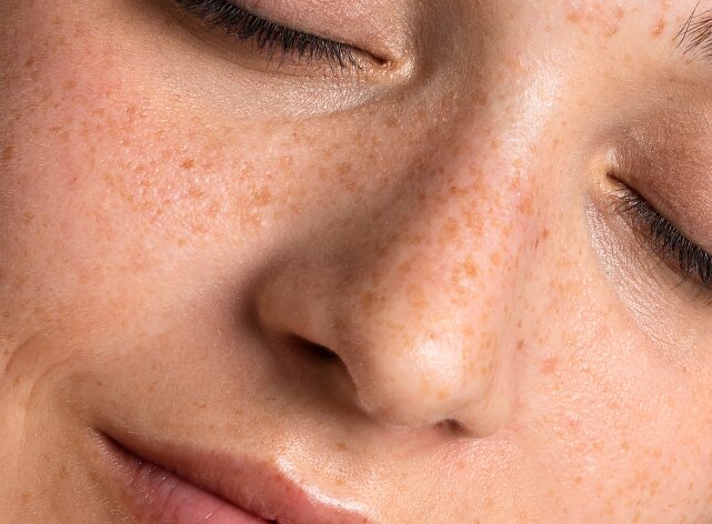 Peles Mistas